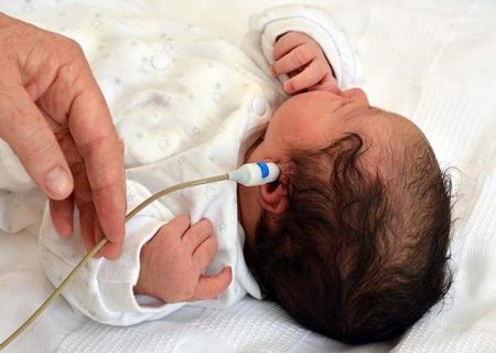 پوشش غربالگری شنوایی ۶۴ هزار نوزاد