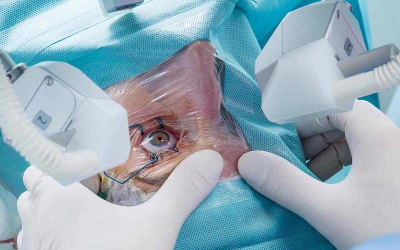 جراحی موفق آب‌مروارید زوج سالمند در ایرانمهر سراوان